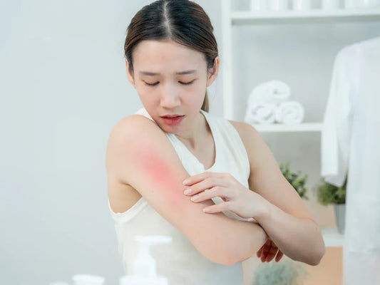 Skin Allergies: Causes, Symptoms, Types, Diagnosis, and Treatment